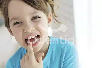 por-que-son-importantes-los-dientes-de-leche-odentid