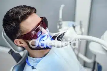 Consejos y recomendaciones después del blanqueamiento dental odentid